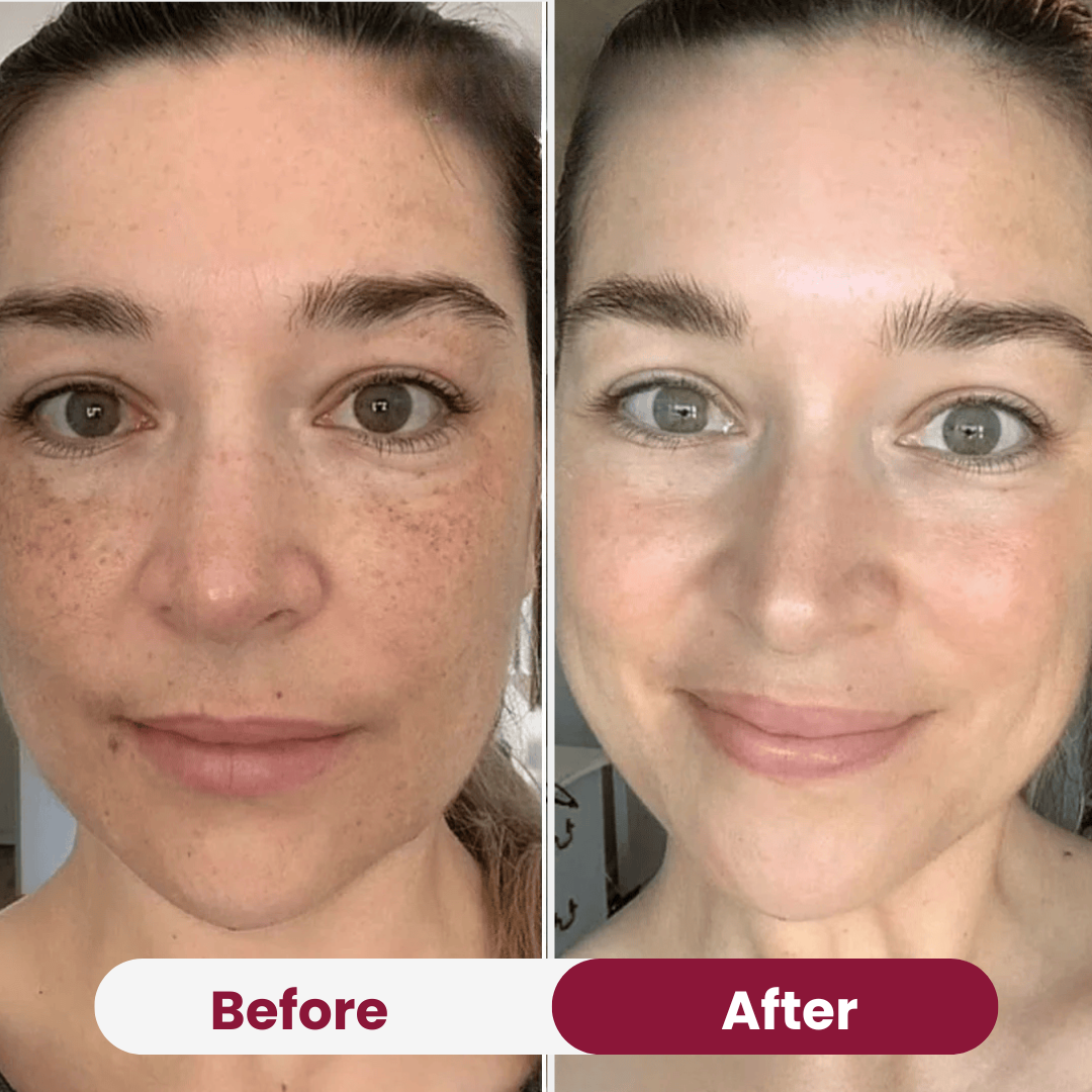bio collagen mask