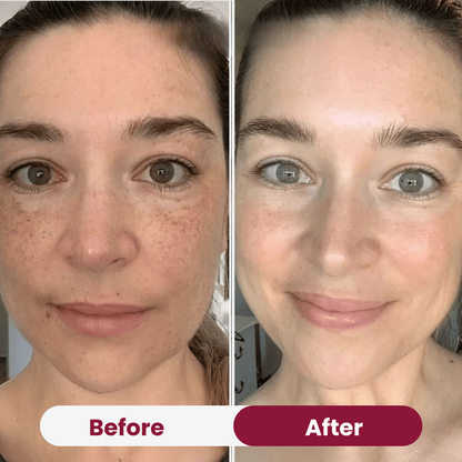 bio collagen mask